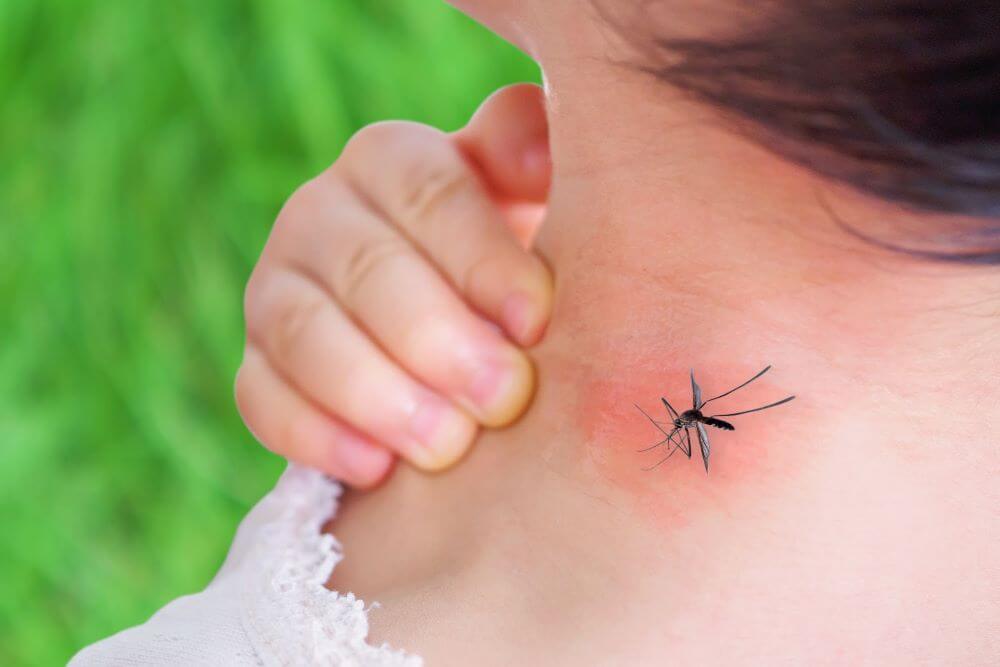 What to Know About Mosquito Bites